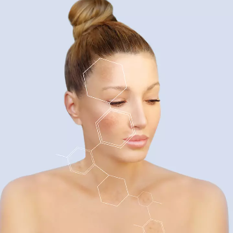 Melasma Treatment